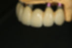 ZH3L9972.JPG