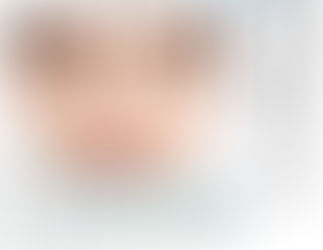 Microneedling PhiBright ✨✨✨