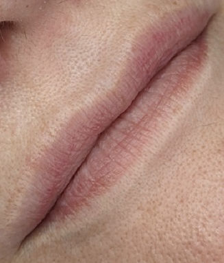 Maquillage semi-permanent Dermopigmentation lèvres dermopigmentation_des_levres_tatouages_levres_naturelle_phi_academie