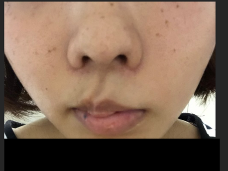 <新規X版>百束比古#美容外科後遺症外来