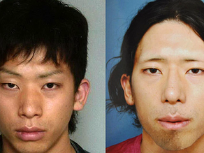 精神疾患と美容外科―人格障害や執着気質も要注意!