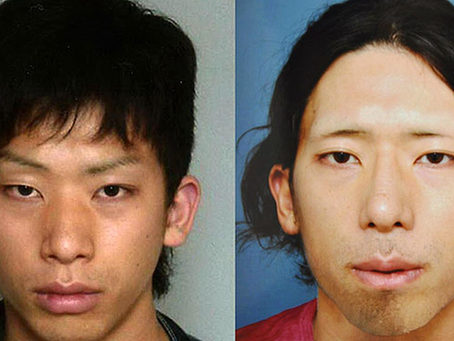 精神疾患と美容外科―人格障害や執着気質も要注意!