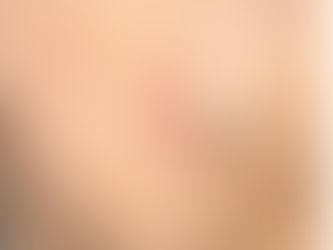 皮膚腫瘍 (良性)