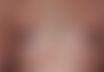 全身病性皮膚疾患―2