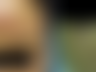 顔面フィラー注入のトラブル