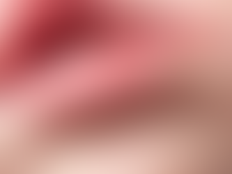 ウイルス性皮膚疾患(罹患の多いヘルペス疾患について)