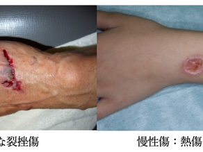 外傷性皮膚疾患