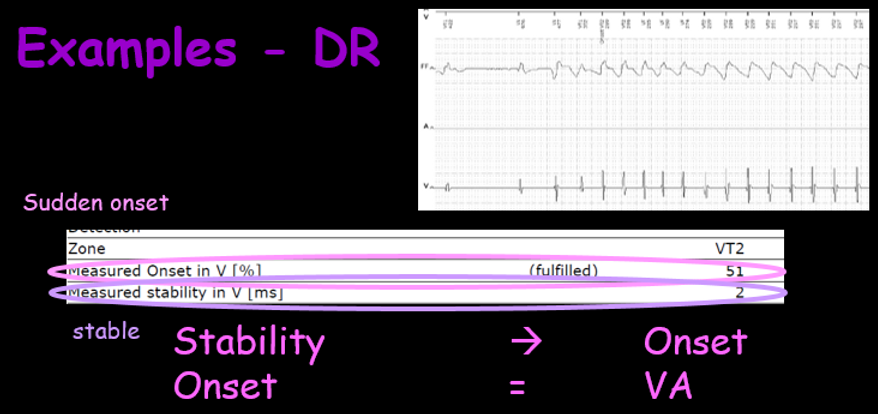 btk dr ex.png