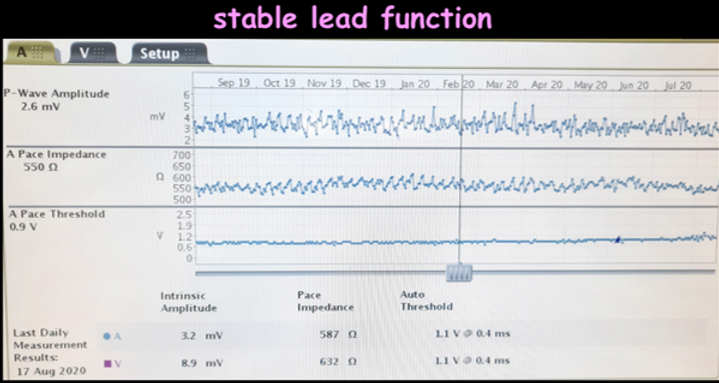 stable lead trend.png