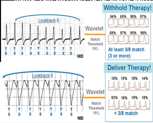 WAVLET.png