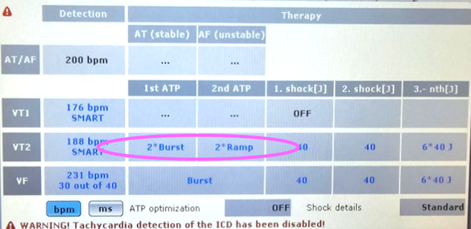 btk atp1.png