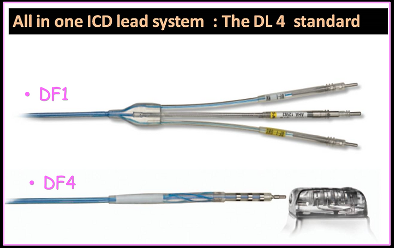 icd implant 3.png