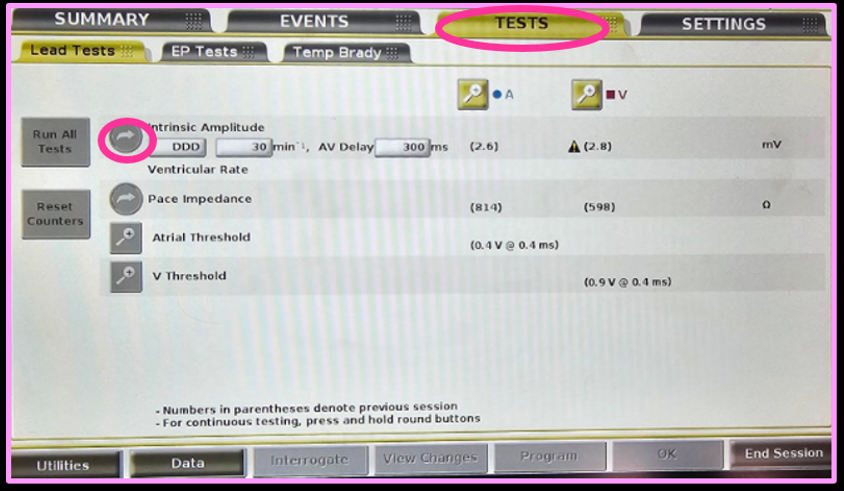 bsc tests sense.png