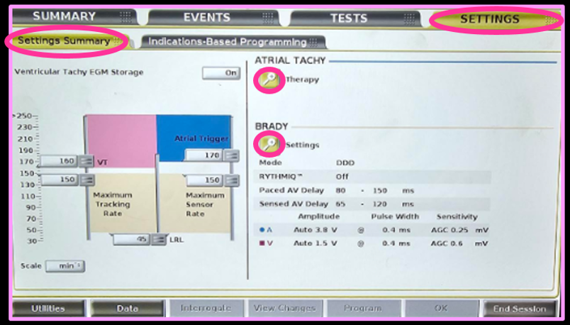 bsc params.png