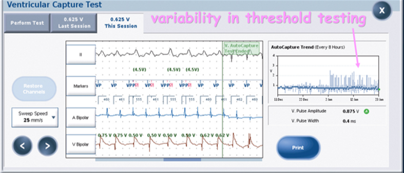 variability in threshold trend.png