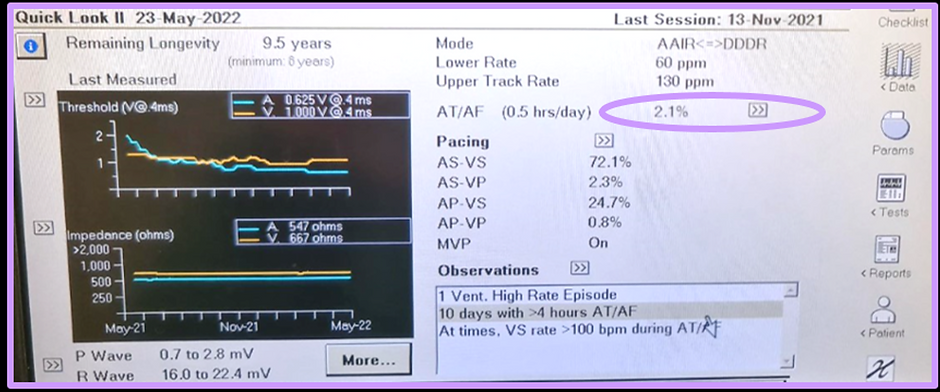 mdt a.png