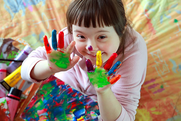 down-syndrome.jpg