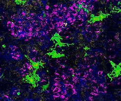 tuberculosis-imaging-1200x1000.jpg