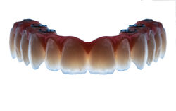 Hybrid1.jpg