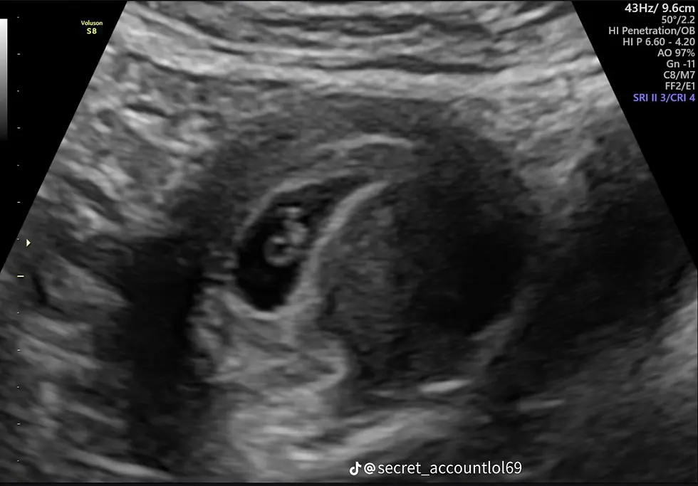Learning to Stay: A Partner’s Journey Through An Unplanned Pregnancy
