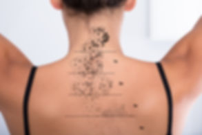 laser tattoo removal surrey appointment inkaway kt22