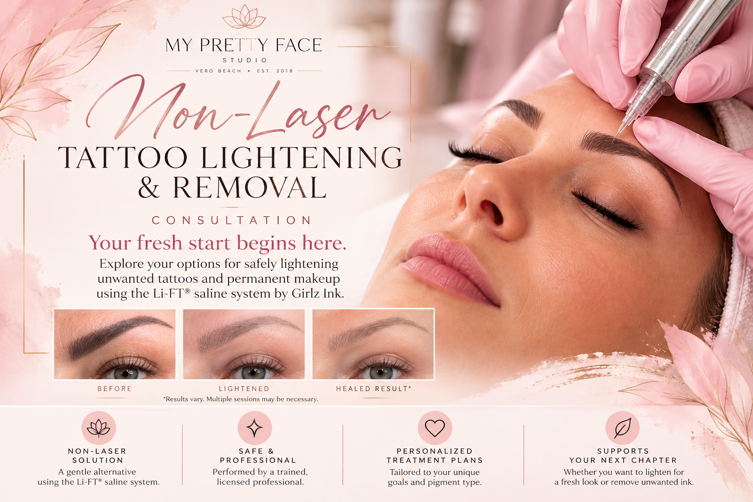 Tattoo Lightening/Removal Consultation