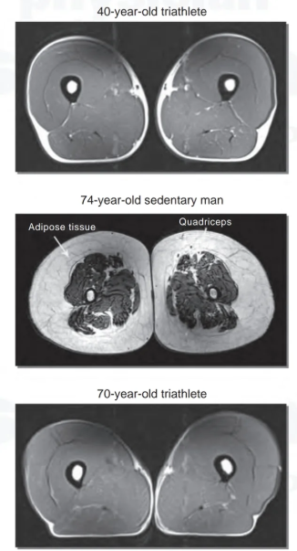 Cross sectional muscle versus fat masses of a 40 year old and 70 year old athlete versus a 74 year old sedentary man
