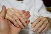 psoriatic-arthritis-vs-osteoarthritis.webp