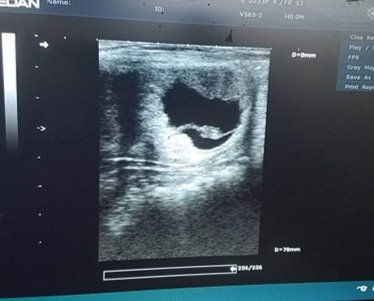 2026 In-Utero Foal