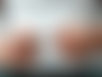 GLP-1 Agonists: Redefining the Future of Weight Management