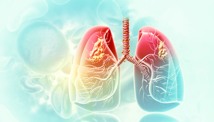 Antibody-Drug Conjugates in Lung Cancer