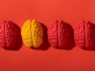 Como funciona o cérebro de um otimista e o que ele faz de diferente