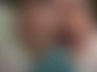 Anquiloglossia: por que a 'língua presa' pode ser perigosa para os bebês