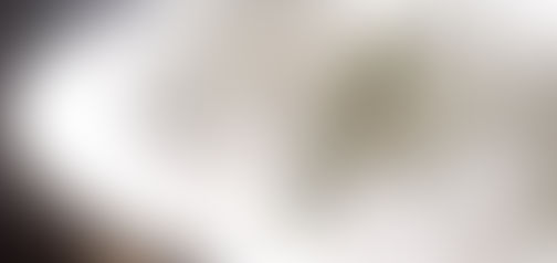 Após nove anos com dor na costela, paciente descobre pedaço de vidro alojado no fígado