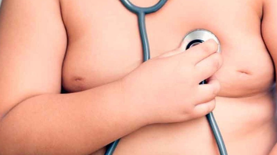 Homens com obesidade podem 'transmitir' problemas para os filhos; entenda mecanismo