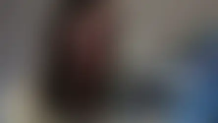 O novo tratamento que vem salvando pacientes com leucemia: 'Ficção científica alguns anos atrás'