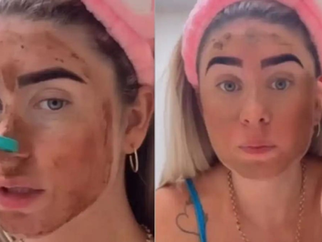 A ciência por trás das modas bizarras de tratamentos de pele, de sêmen de salmão a cocô de passarinho