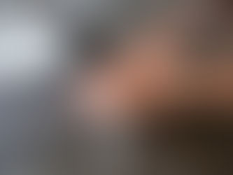 Alergia à água: entenda doença rara que leva pessoas a evitarem banhos