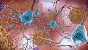 Proteína ligada ao Alzheimer se espalha pelo cérebro por conexões entre neurônios, mostra estudo