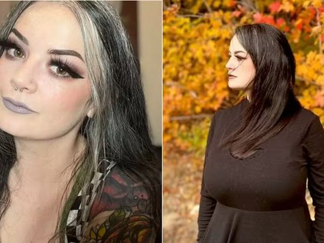 Mulher fica grávida após ter as trompas laqueadas nos EUA
