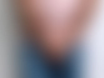 Médicos relatam caso raríssimo de homem com três pênis