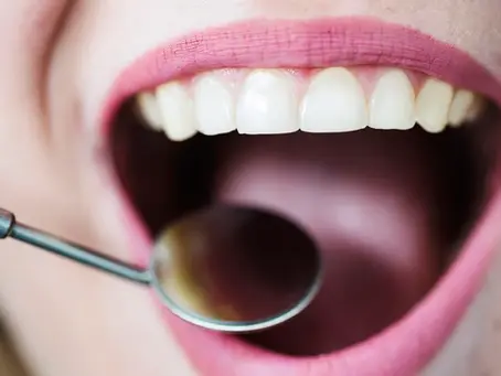 Medicamento que faz crescer dentes perdidos entra em testes no Japão