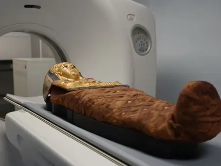 Pela primeira vez, cientistas fazem 'tomografia' em múmias egípcias e descobrem sinais de doenças de mais de 2.300 anos