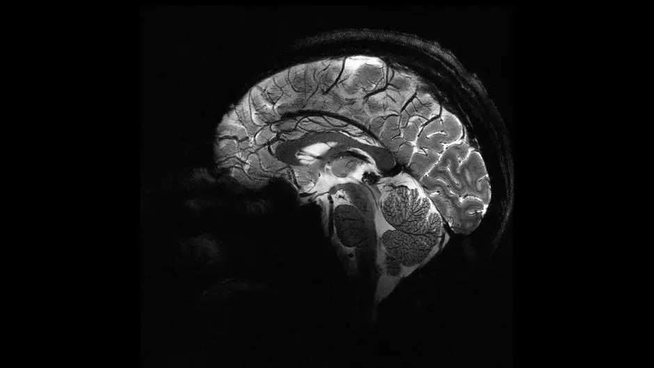 Pela 1ª vez, cientistas mapeiam como o cérebro envelhece em cada região; entenda