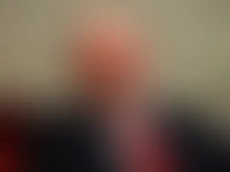 O que é leucoplasia, problema que motivou cirurgia em Lula