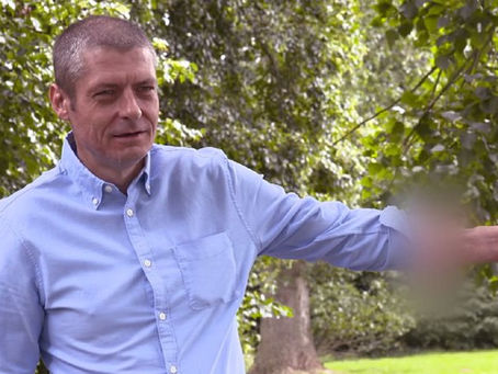 O homem que passou seis anos com um pênis implantado no braço