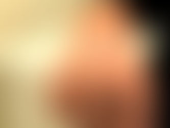 Associação de implante de matriz de regeneração dérmica com curativo com pressão negativa já é conse