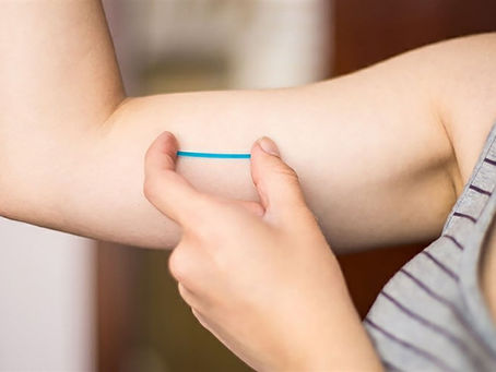 Contraceptivo de até R$ 4 mil, Implanon passa a ser oferecido pelos planos de saúde a partir desta segunda (1º)