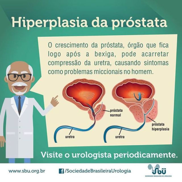 Próstata