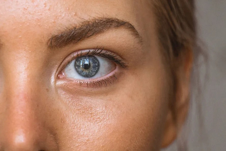 Produto de beleza usado por milhões está fazendo os olhos das pessoas mudarem de cor; entenda